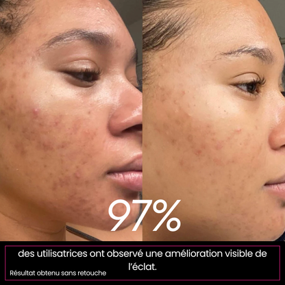 SoSoGlowy - Crème correctrice anti-taches & unifiante - Arbutine + Acide Tranexamique