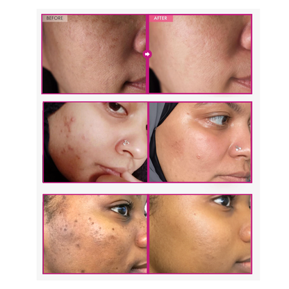 SoSoGlowy - Crème correctrice anti-taches & unifiante - Arbutine + Acide Tranexamique